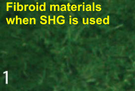 Fibroid materials when SHG is used